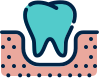 Diş İmplant